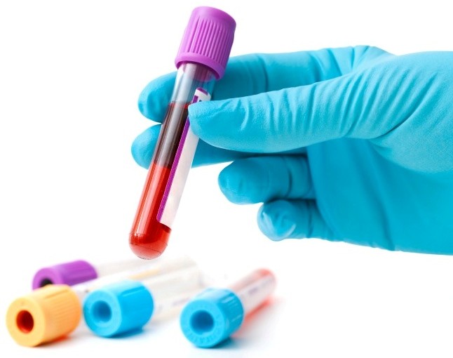 Biofluids