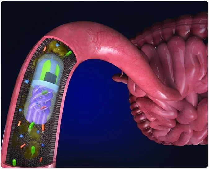 Gastrointestinal Disorders Research Samples