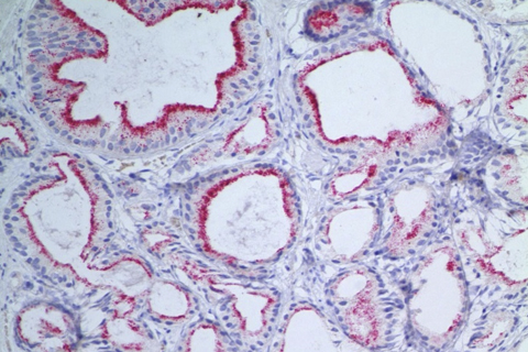 Genitourinary Research Samples